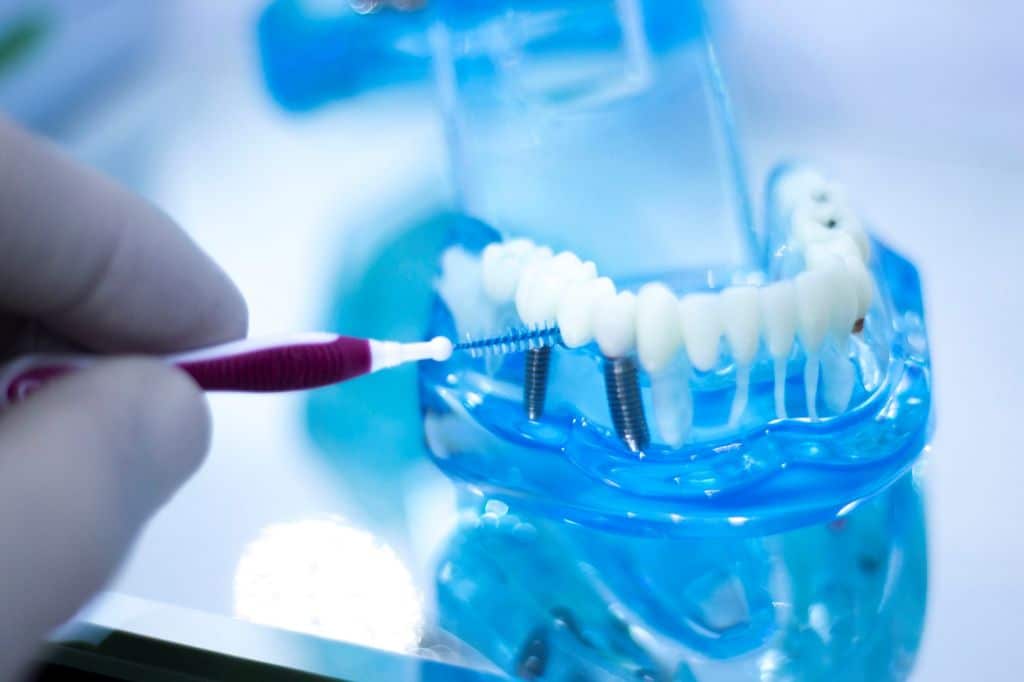 Maintaining and Caring for Dental Implants